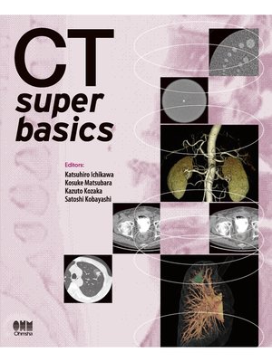 cover image of CT super basics